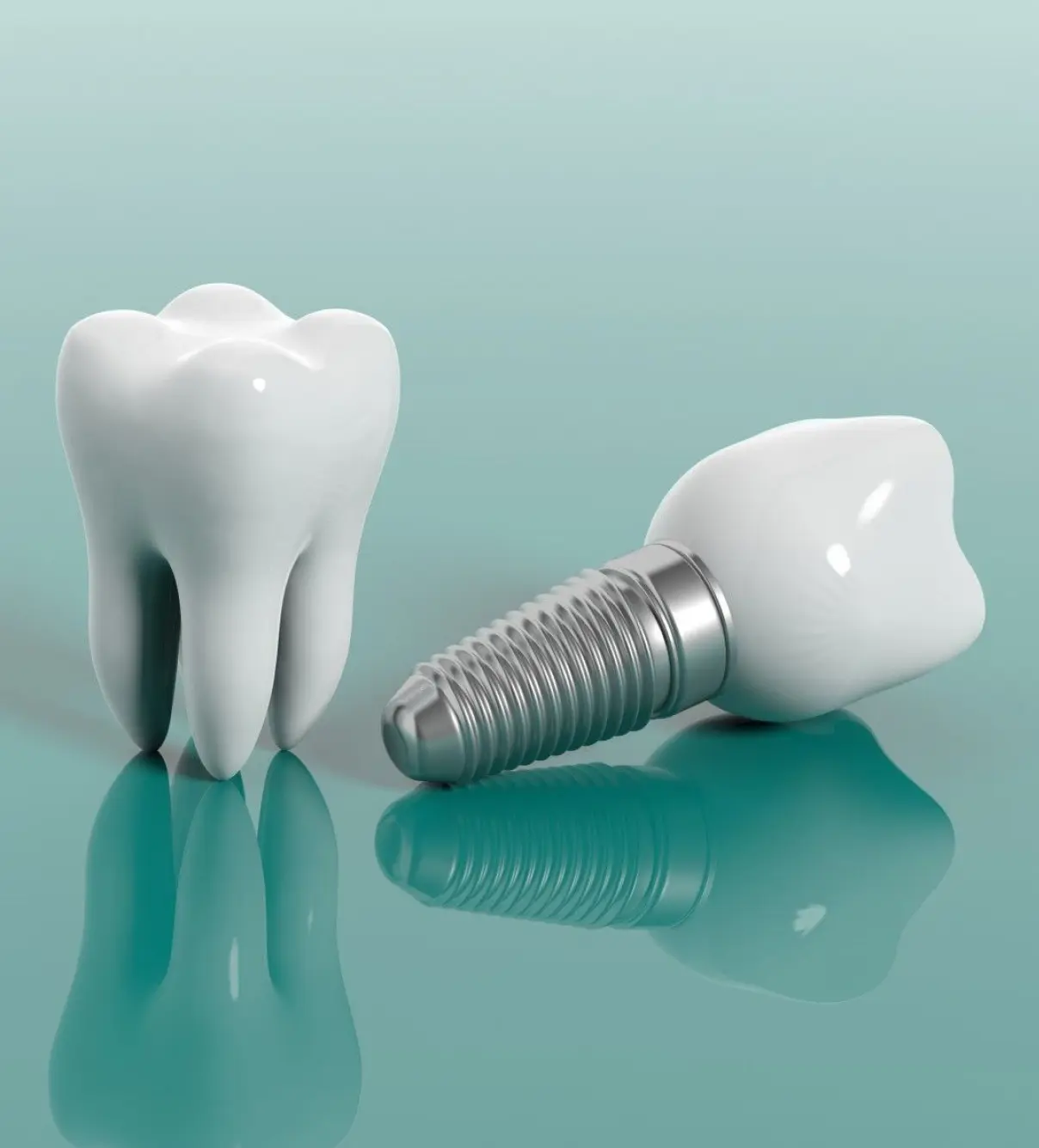 implants au cabinet CG Dentaire à Montauban